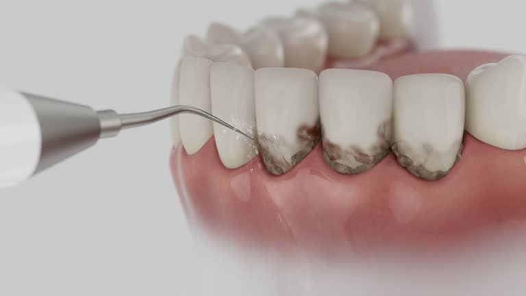Reliable Dental Implants contractor in Dexter, NM by Smile Center Dentistry